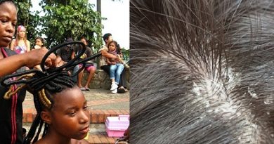 LICE INFESTATION: How To Avoid And Overcome It