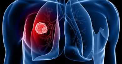 Why Antioxidants May Encourage Spread Of Lung Cancer Rather Than Prevent It