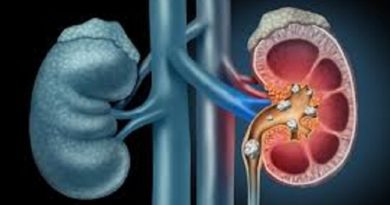 COVID-19: Issues Related to Kidney Failure, Kidney Transplant and Hypertension