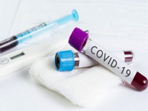 No Confirmed Case of Coronavirus in Plateau, Says Govt