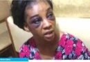 My Husband Stabbed Me and Locked Me Up for Days
