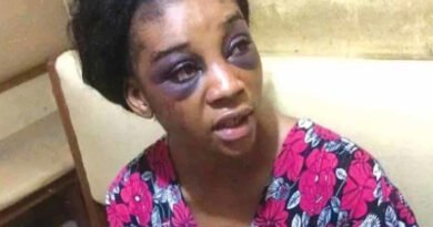 My Husband Stabbed Me and Locked Me Up for Days