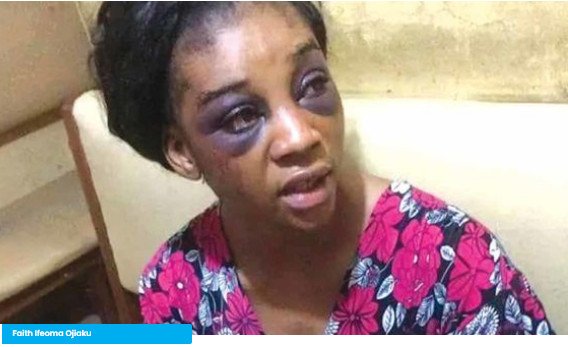 My Husband Stabbed Me and Locked Me Up for Days